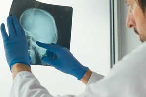 medical malpractice beverly hills doctor looking at skull